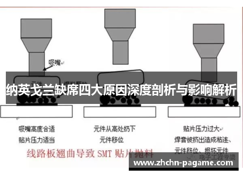 纳英戈兰缺席四大原因深度剖析与影响解析